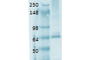 Western Blot analysis of Human thyroid lysate showing detection of Sodium Iodide Symporter protein using Mouse Anti-Sodium Iodide Symporter Monoclonal Antibody, Clone 14F . (SLC5A5 抗体  (AA 468-643) (APC))