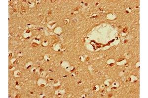Immunohistochemistry of paraffin-embedded human brain tissue using ABIN7152586 at dilution of 1:100 (FEZ1 抗体  (AA 12-200))