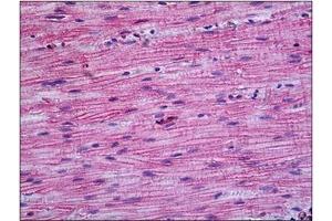 Human Intestine, Muscularis Propria: Formalin-Fixed, Paraffin-Embedded (FFPE) (PPP3CA 抗体  (N-Term))