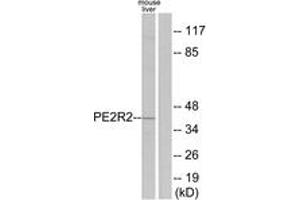 Western blot analysis of extracts from mouse liver cells, using PE2R2 Antibody. (PTGER2 抗体  (AA 261-310))