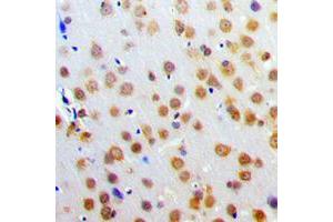 Immunohistochemical analysis of SNAP25 staining in human brain formalin fixed paraffin embedded tissue section. (SNAP25 抗体  (C-Term))