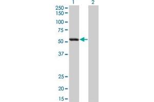 Western Blot analysis of SIGLEC6 expression in transfected 293T cell line by SIGLEC6 monoclonal antibody (M02), clone 2G6. (SIGLEC6 抗体  (AA 371-453))