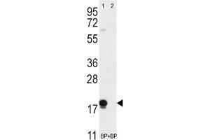Western Blotting (WB) image for anti-CD90 (THY1) antibody (ABIN3001433) (CD90 抗体)