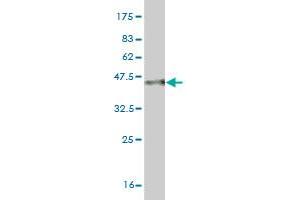 Western Blot detection against Immunogen (35. (MYO3A 抗体  (AA 1400-1490))