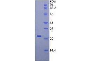 SDS-PAGE analysis of Mouse CD8b Protein. (CD8B 蛋白)
