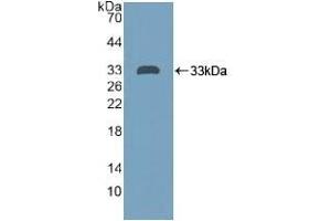 Detection of Recombinant PTPRH, Human using Polyclonal Antibody to Protein Tyrosine Phosphatase Receptor Type H (PTPRH) (PTPRH 抗体  (AA 844-1096))