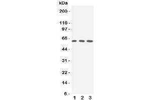 Western blot testing of SLC22A3 antibody and Lane 1:  rat liver;  2: human 293T;  3: (h) A549 cell lysate. (SLC22A3 抗体  (N-Term))