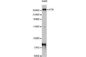 Western blot analysis of extracts of H460 cells, using ATM Antibody (ABIN5973499) at 1/1000 dilution. (ATM 抗体)