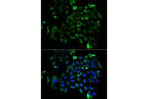 Immunofluorescence analysis of A549 cells using EEF1B2 antibody (ABIN5973953). (EEF1B2 抗体)