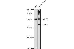 Western blot analysis of extracts of various cell lines, using MMP3 antibody (ABIN3021708, ABIN3021709, ABIN3021710 and ABIN6215578) at 1:1000 dilution. (MMP3 抗体  (AA 248-477))