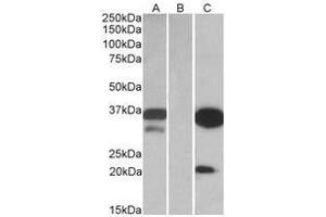 HEK293 lysate (10 µg protein in RIPA buffer) over expressing Human DAPP1 with DYKDDDDK tag probed with this Antibody (0. (DAPP1 抗体  (Internal Region))