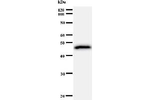 Western Blotting (WB) image for anti-General Transcription Factor II I Repeat Domain-Containing 1 (GTF2IRD1) antibody (ABIN930918) (GTF2IRD1 抗体)