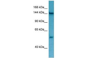 WB Suggested Anti-TPP2 Antibody Titration: 1.
