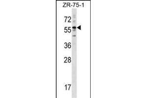 KRT3 Antibody (Center) (ABIN1538406 and ABIN2848455) western blot analysis in ZR-75-1 cell line lysates (35 μg/lane). (Keratin 3 抗体  (AA 414-441))