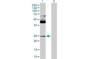 Western Blot analysis of MAX expression in transfected 293T cell line by MAX MaxPab polyclonal antibody. (MAX 抗体  (AA 1-151))