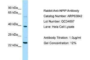 Western Blotting (WB) image for anti-Nuclear Pore Complex Interacting Protein Family, Member A1 (NPIPA1) (Middle Region) antibody (ABIN2789641) (NPIPA1 抗体  (Middle Region))
