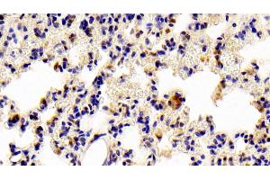 Immunohistochemistry (IHC) image for anti-Signal Transducer and Activator of Transcription 6, Interleukin-4 Induced (STAT6) (AA 557-841) antibody (ABIN7439333)