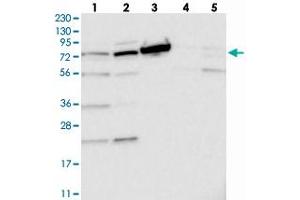 Western blot analysis of Lane 1: RT-4, Lane 2: U-251 MG, Lane 3: Human Plasma, Lane 4: Liver, Lane 5: Tonsil with TOP1MT polyclonal antibody . (TOP1MT 抗体)