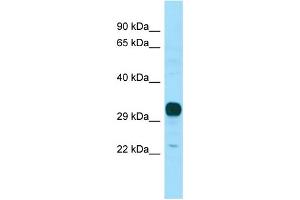 WB Suggested Anti-NPBWR1 Antibody Titration: 1. (NPBWR1 抗体  (N-Term))