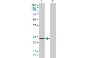 Western Blot analysis of LYG2 expression in transfected 293T cell line by LYG2 MaxPab polyclonal antibody. (LYG2 抗体  (AA 1-212))