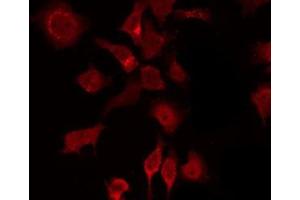 ABIN6275518 staining K562 by IF/ICC. (DVL2 抗体  (C-Term))