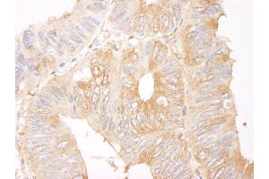 anti-Coronin, Actin Binding Protein, 1B (CORO1B) (AA 450-489) antibody