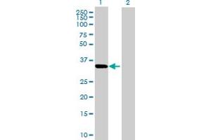 Western Blot analysis of CBR3 expression in transfected 293T cell line by CBR3 MaxPab polyclonal antibody. (CBR3 抗体  (AA 1-277))