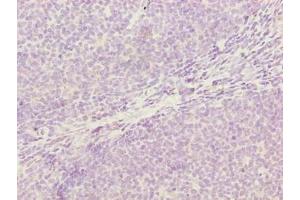 Immunohistochemistry of paraffin-embedded human tonsil tissue using ABIN7142334 at dilution of 1:100 (OXSM 抗体  (AA 78-345))