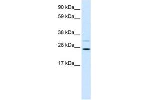 Western Blotting (WB) image for anti-Fibrinogen Silencer Binding Protein (FSBP) antibody (ABIN2460571)