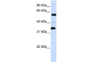 WB Suggested Anti-ZKSCAN1 Antibody Titration:  0. (ZKSCAN1 抗体  (Middle Region))