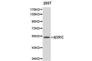 Western Blotting (WB) image for anti-Activin Receptor Type 1C (ACVR1C) antibody (ABIN1870797) (ACVR1C/ALK7 抗体)