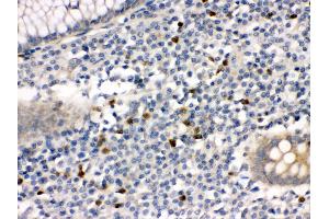 Anti- MMP8 Picoband antibody,IHC(P) IHC(P): Human Appendicitis Tissue (MMP8 抗体  (N-Term))