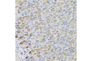 Immunohistochemistry of paraffin-embedded mouse stomach using LDHB antibody at dilution of 1:100 (x40 lens). (LDHB 抗体)