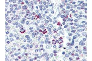 Human Spleen (formalin-fixed, paraffin-embedded) stained with LIN28Bfollowed by biotinylated goat anti-rabbit IgG secondary antibody, alkaline phosphatase-streptavidin and chromogen. (LIN28B 抗体  (N-Term))