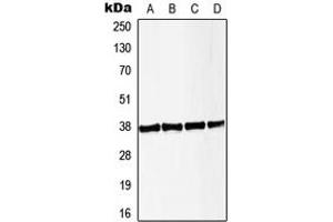 Western blot analysis of LAT (pY191) expression in HeLa PMA-treated (A), Jurkat CD3-treated (B), Raw264. (LAT 抗体  (C-Term, pTyr191))