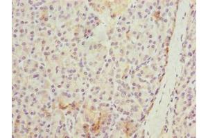 Immunohistochemistry of paraffin-embedded human pancreatic tissue using ABIN7175794 at dilution of 1:100 (WDR74 抗体  (AA 111-366))