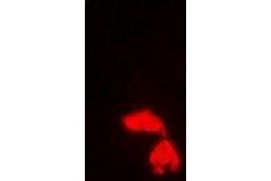 Immunofluorescent analysis of PA28 gamma staining in Hela cells. (PSME3 抗体)