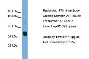WB Suggested Anti-STK11  Antibody Titration: 0.