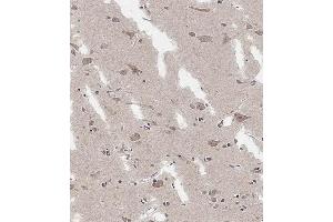 Immunohistochemical analysis of  on paraffin-embedded Human brain tissue.