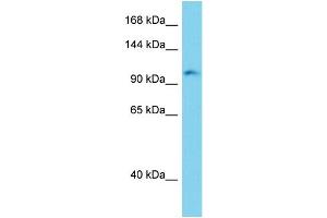 Host: Rabbit Target Name: Erc2 Sample Type: Mouse Liver lysates Antibody Dilution: 1. (ERC2 抗体  (C-Term))