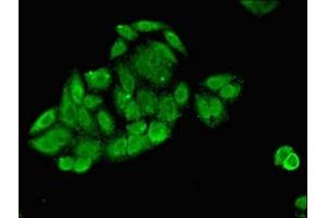 Immunofluorescent analysis of HepG2 cells using ABIN7173369 at dilution of 1:100 and Alexa Fluor 488-congugated AffiniPure Goat Anti-Rabbit IgG(H+L) (Slc25a1 抗体  (AA 144-182))