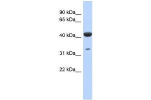 HCG_1745121 antibody used at 1 ug/ml to detect target protein. (ISPD 抗体  (N-Term))