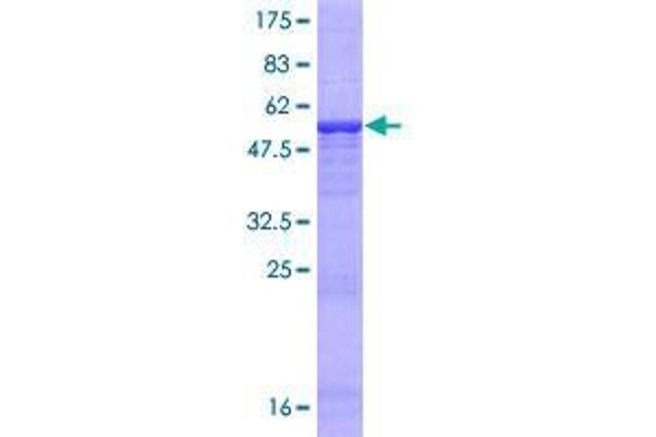 CECR1 Protein (AA 1-270) (GST tag)