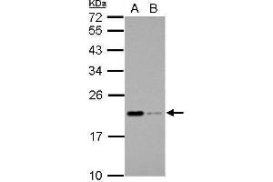 WB Image Sample (30 ug of whole cell lysate) A: THP-1 B: HL-60 12% SDS PAGE antibody diluted at 1:1000 (Apolipoprotein M 抗体)