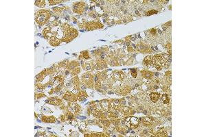 Immunohistochemistry of paraffin-embedded human stomach using ATG5 antibody (ABIN5997274) at dilution of 1/100 (40x lens). (ATG5 抗体)