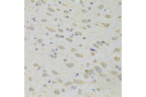 Immunohistochemistry of paraffin-embedded rat brain using PPP2R1B Antibody (ABIN2564666) at dilution of 1:100 (40x lens). (PPP2R1B 抗体)