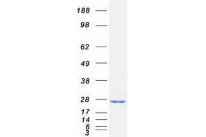 Western Blotting (WB) image for RAB17, Member RAS Oncogene Family (RAB17) protein (Myc-DYKDDDDK Tag) (ABIN2730280)