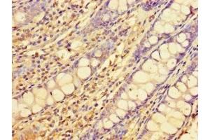 Immunohistochemistry of paraffin-embedded human colon tissue using ABIN7151556 at dilution of 1:100 (ELOVL1 抗体  (AA 82-175))