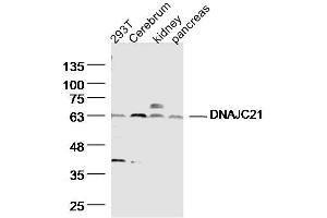 Lane 1: HT29 Cell lysates; Lane 2: mouse Cerebrum Cell lysates; Lane 3: Mouse kidney lysates; Lane 4: Mouse pancreas lysates; probed with DNAJC21 Polyclonal Antibody, unconjugated (bs-14387R) at 1:300 overnight at 4°C followed by a conjugated secondary antibody for 60 minutes at 37°C. (DNAJC21 抗体  (AA 11-120))