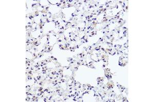 Immunohistochemistry of paraffin-embedded rat lung using NFIB Rabbit pAb (ABIN7268973) at dilution of 1:250 (40x lens). (NFIB 抗体  (C-Term))